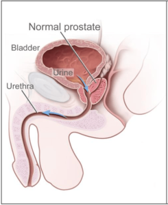 What is Prostate