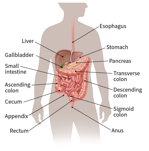 colorectal cancer